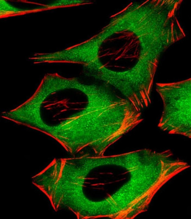 PIP4K2A Antibody in Immunocytochemistry (ICC/IF)