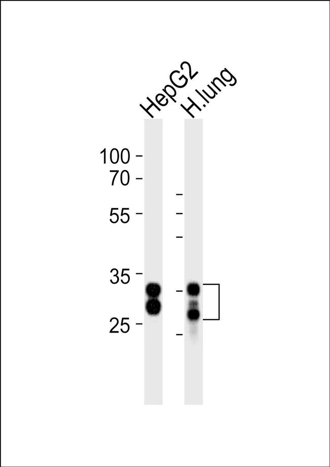 SULT1A1 Antibody in Western Blot (WB)