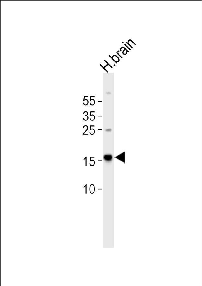 LC3A Antibody in Western Blot (WB)