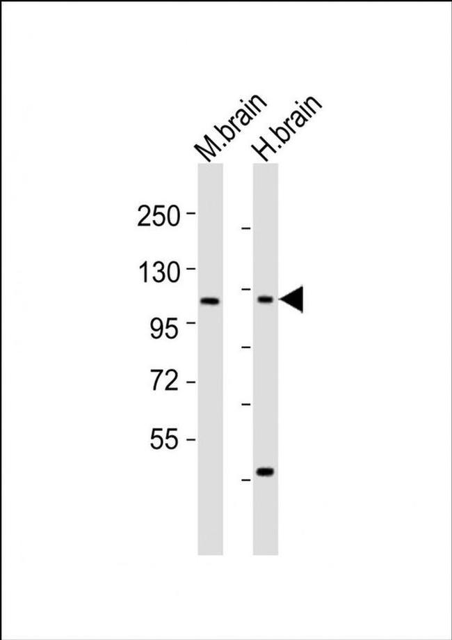 CHSY3 Antibody in Western Blot (WB)