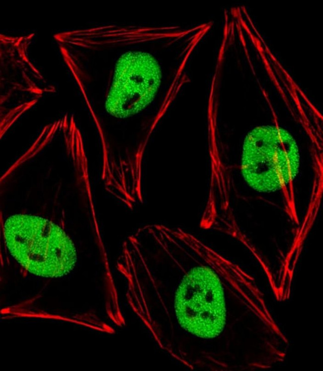 PDX1 Antibody in Immunocytochemistry (ICC/IF)