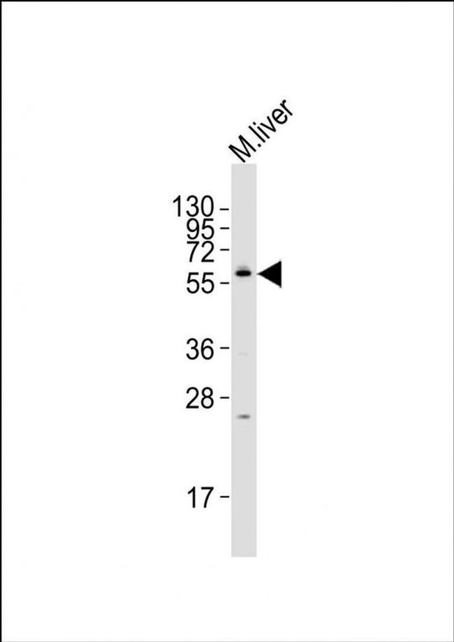 NRBP2 Antibody in Western Blot (WB)