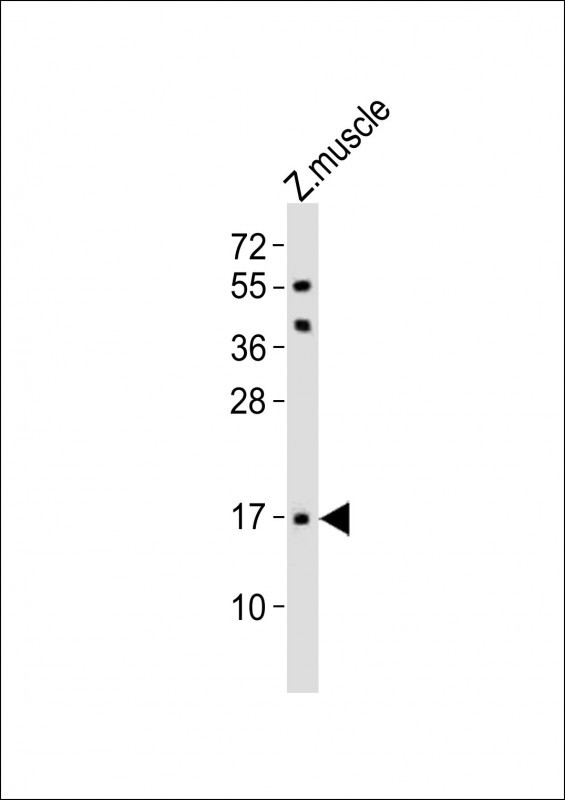 TMEM166 Antibody in Western Blot (WB)