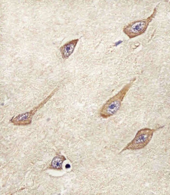 FAM168B Antibody in Immunohistochemistry (IHC)