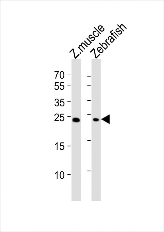 SOGA3B Antibody in Western Blot (WB)