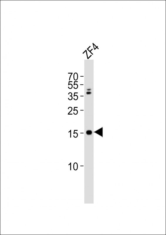 GABARAPL2 Antibody in Western Blot (WB)