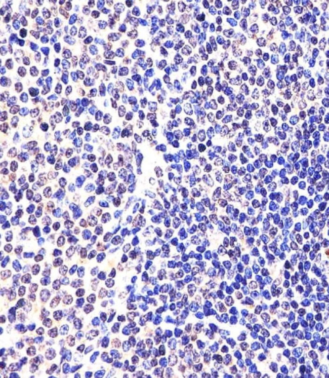 EED Antibody in Immunohistochemistry (IHC)