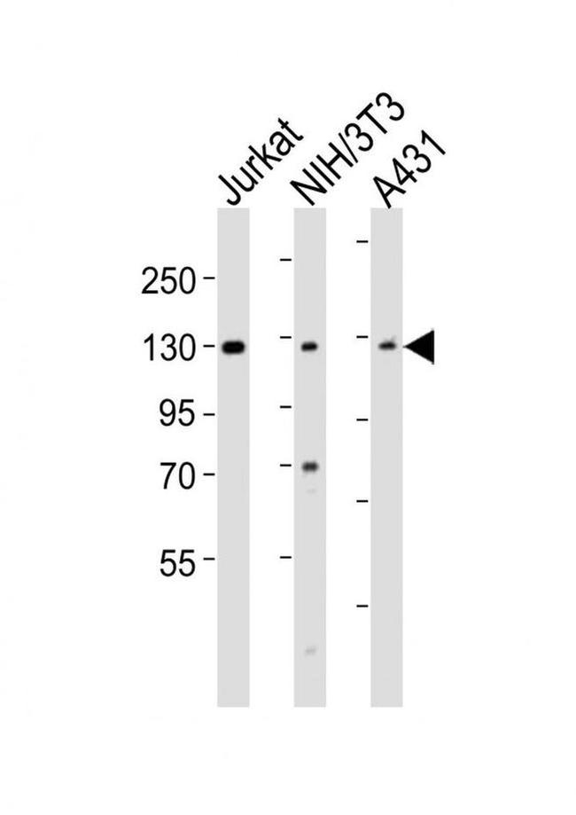 hnRNP U Antibody in Western Blot (WB)