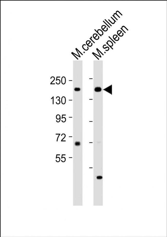 KDM6A Antibody in Western Blot (WB)