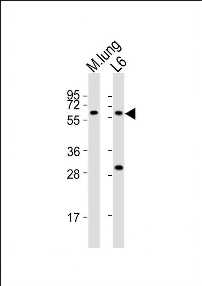 YES1 Antibody in Western Blot (WB)