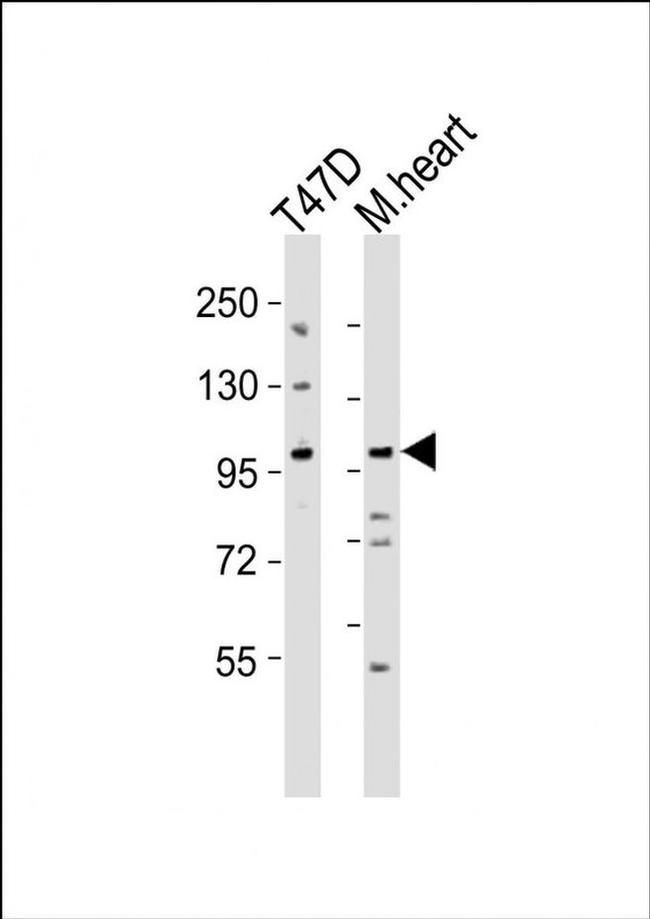 CLEC16A Antibody in Western Blot (WB)