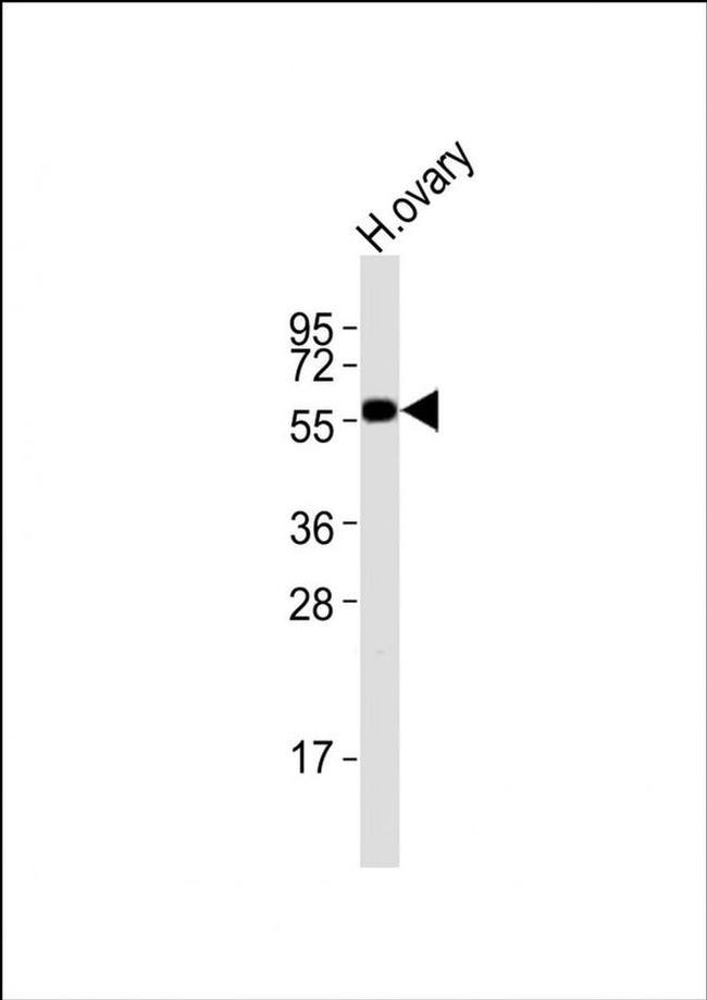DRD5 Antibody in Western Blot (WB)