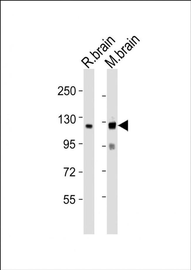 NLGN3 Antibody in Western Blot (WB)