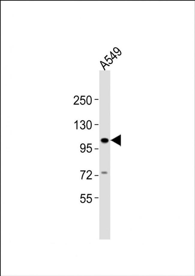 CHSY3 Antibody in Western Blot (WB)