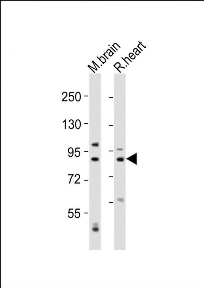 Calpain 5 Antibody in Western Blot (WB)