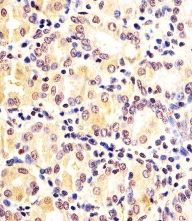 FN3KRP Antibody in Immunohistochemistry (IHC)