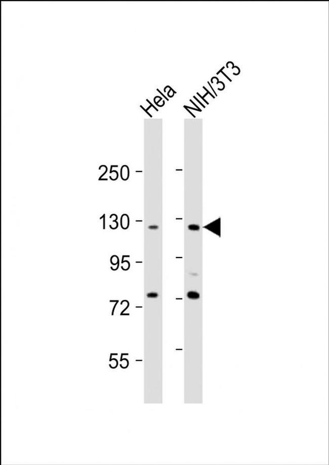 AATK Antibody in Western Blot (WB)