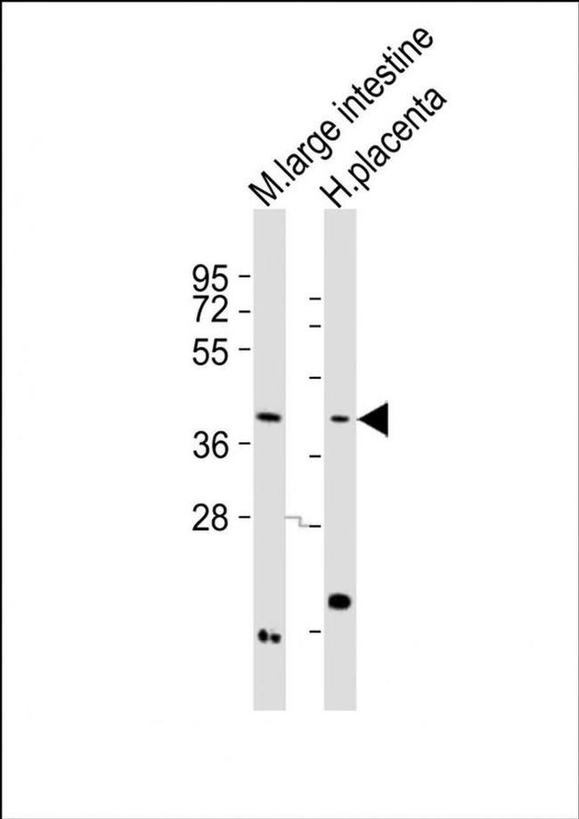 MC3R Antibody in Western Blot (WB)