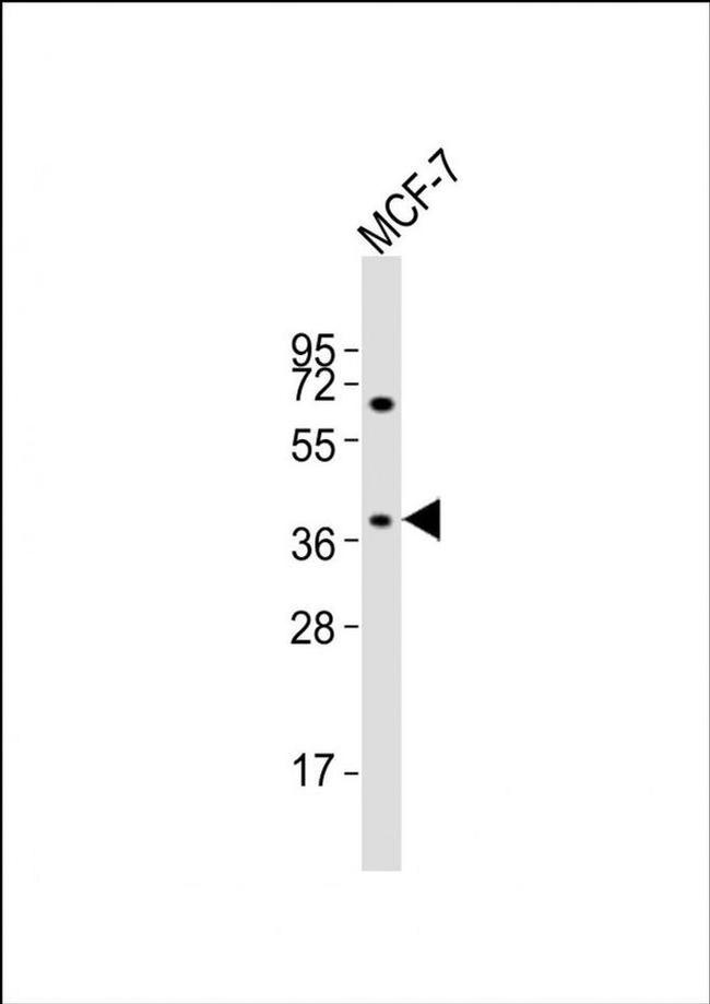 OR11H4 Antibody in Western Blot (WB)