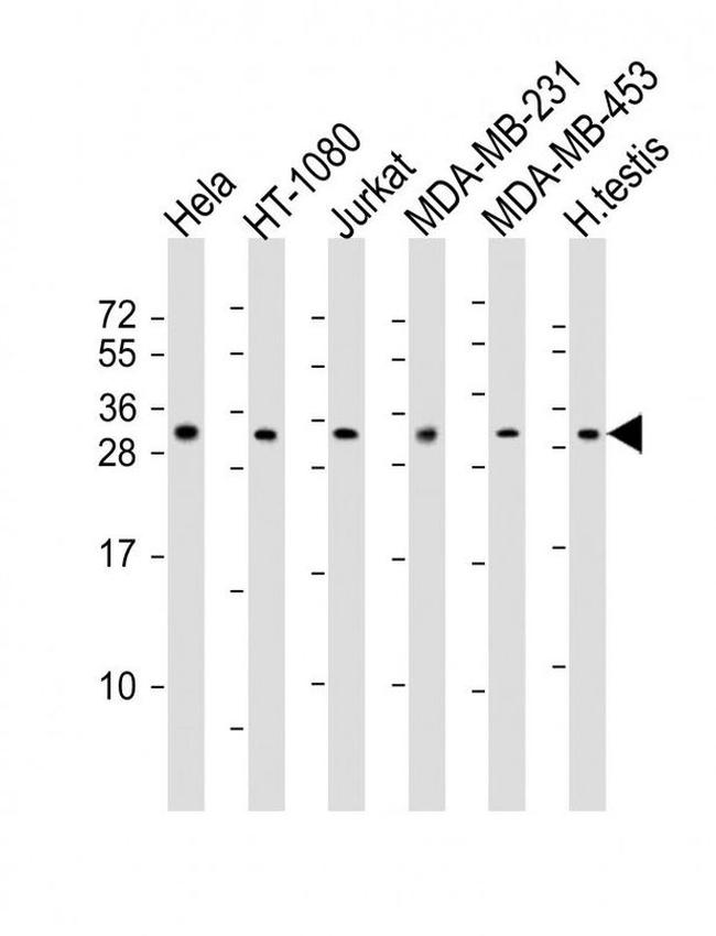SSX2 Antibody in Western Blot (WB)