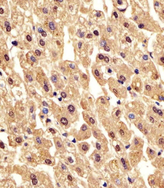 PGM1 Antibody in Immunohistochemistry (IHC)