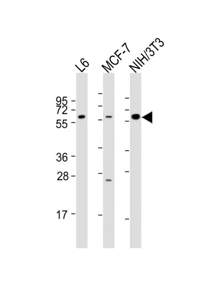 YES1 Antibody in Western Blot (WB)