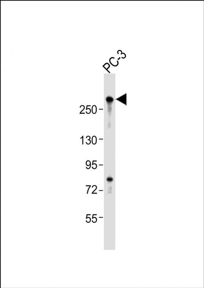 RLF Antibody in Western Blot (WB)