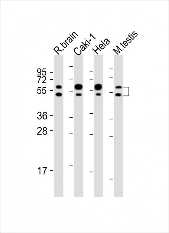 NKIAMRE Antibody in Western Blot (WB)