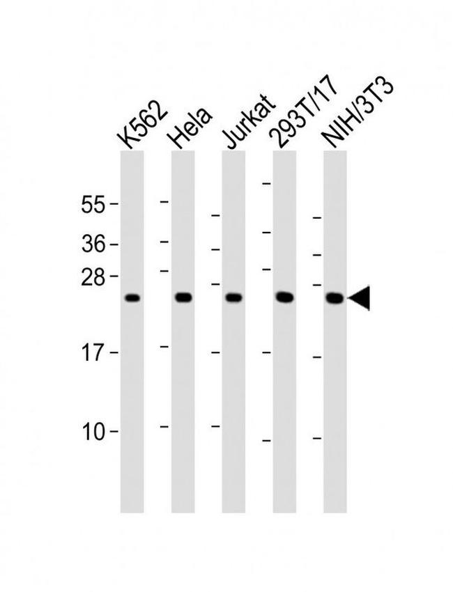PSMB3 Antibody in Western Blot (WB)