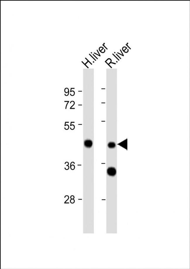 CR16 Antibody in Western Blot (WB)