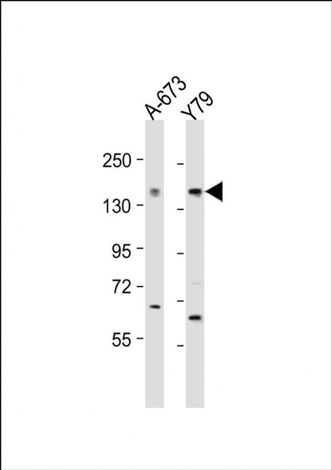 CACNA1F Antibody in Western Blot (WB)