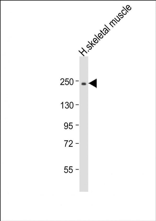 MYH2 Antibody in Western Blot (WB)