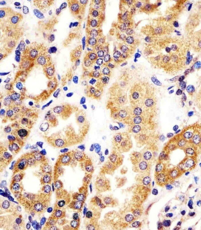 HTR1E Antibody in Immunohistochemistry (IHC)