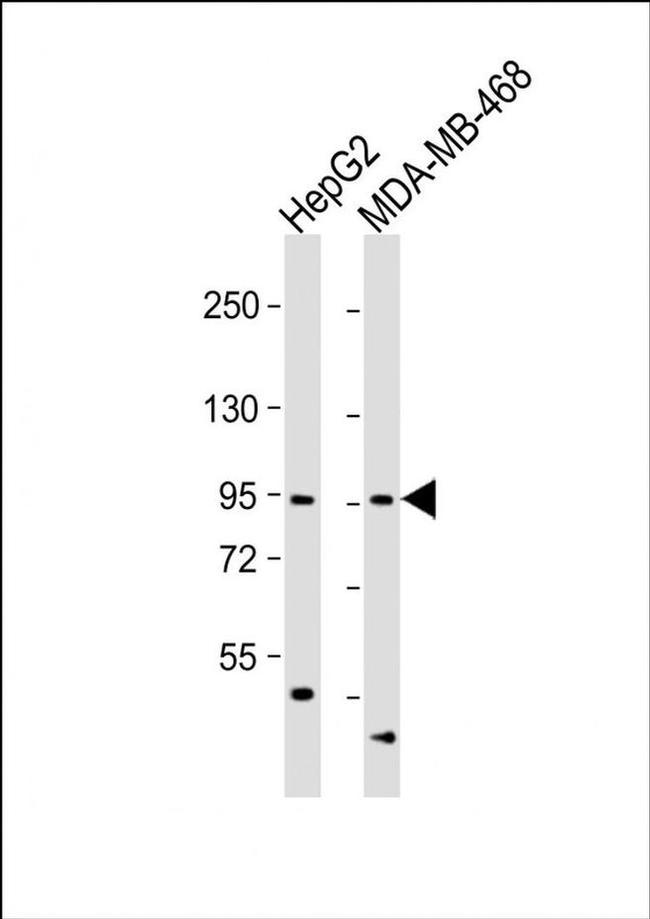 OPHN1 Antibody in Western Blot (WB)