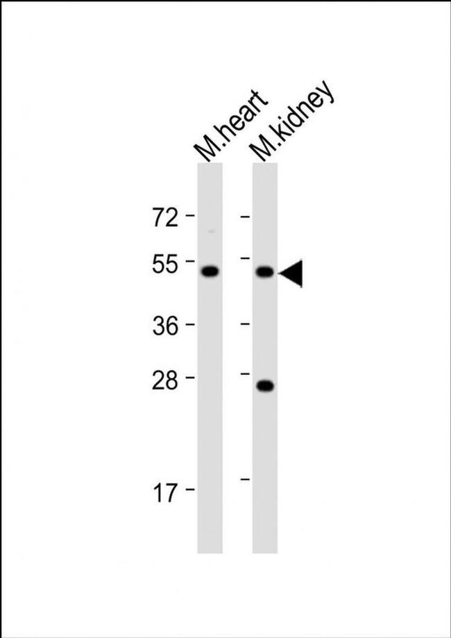 PIGU Antibody in Western Blot (WB)