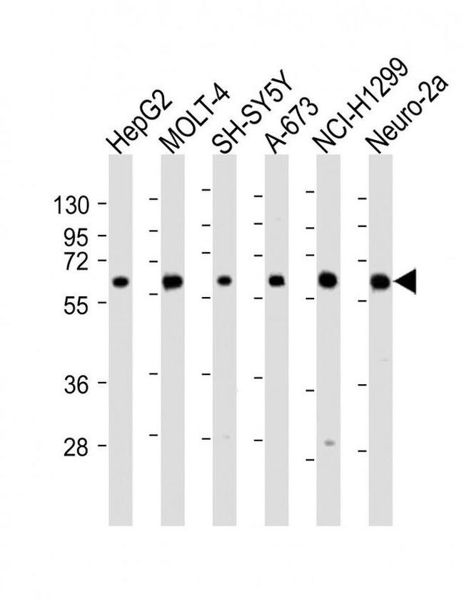 CHRNA4 Antibody in Western Blot (WB)