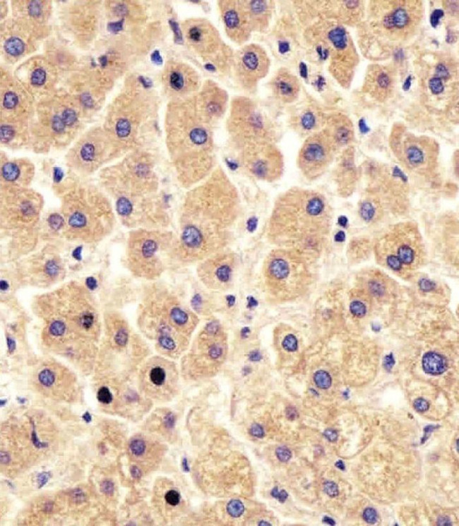 PYGL Antibody in Immunohistochemistry (IHC)