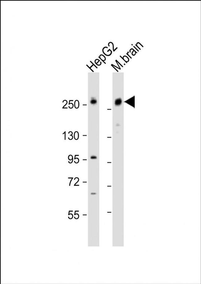 RALGAPA1 Antibody in Western Blot (WB)