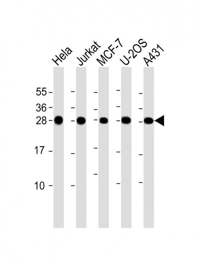 RPL14 Antibody in Western Blot (WB)