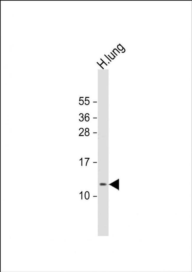 DKK3 Antibody in Western Blot (WB)