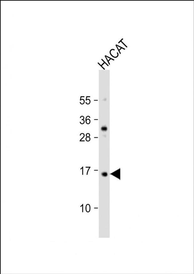 TCTA Antibody in Western Blot (WB)