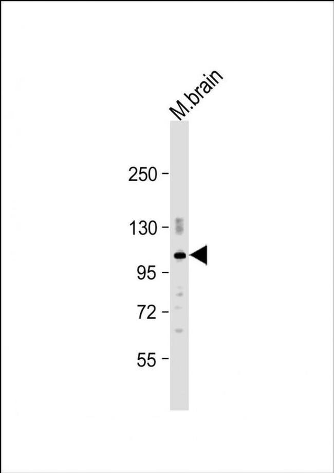 PDE2A Antibody in Western Blot (WB)