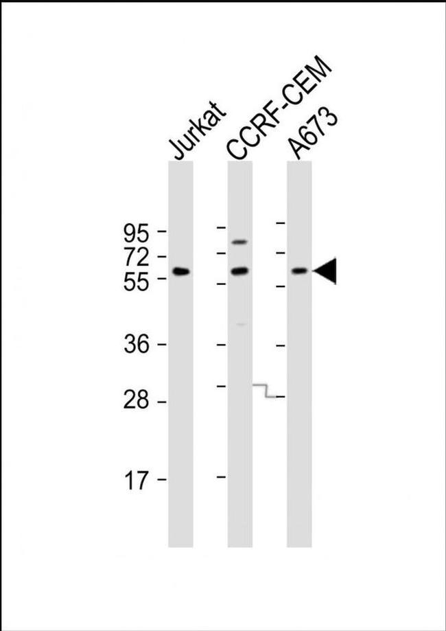 CESK1 Antibody in Western Blot (WB)