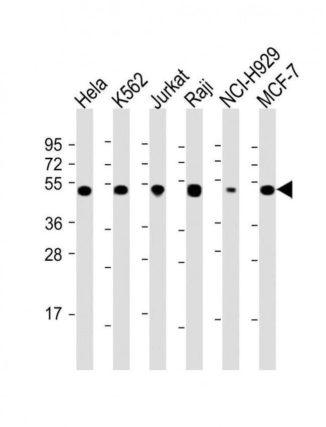 RPL4 Antibody in Western Blot (WB)