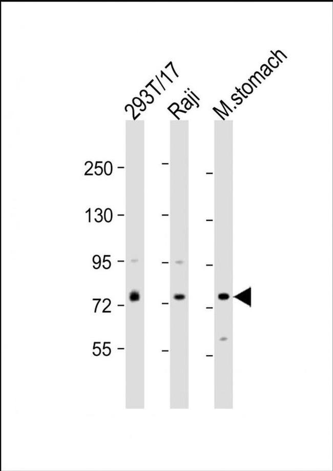 PLA2G4F Antibody in Western Blot (WB)