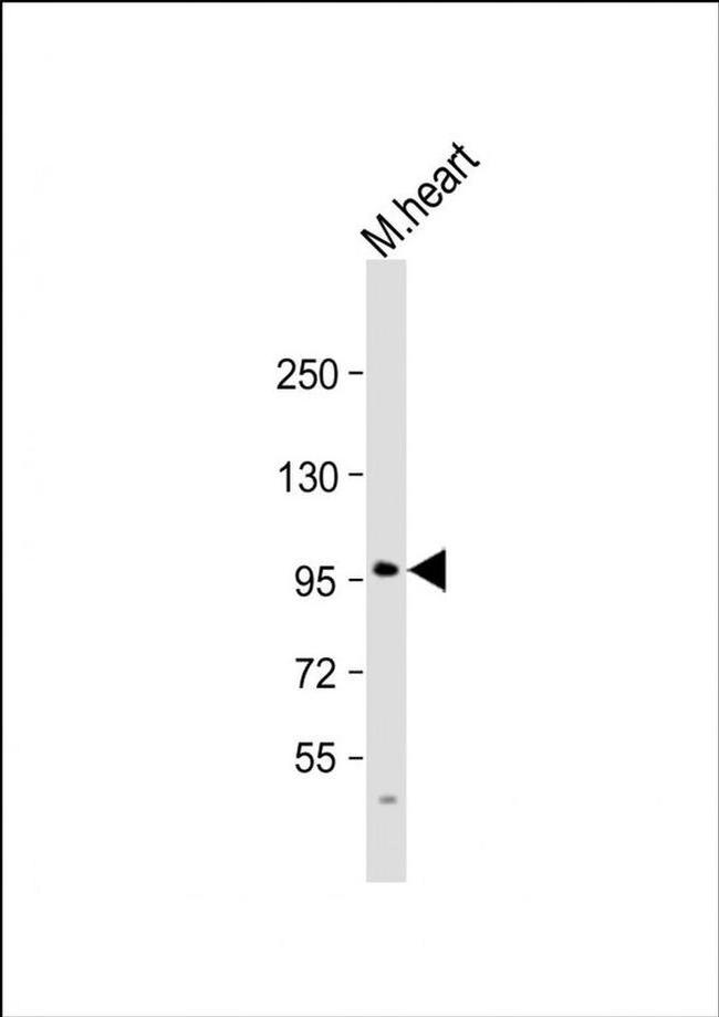 MIB2 Antibody in Western Blot (WB)