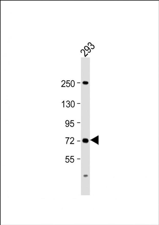 SLC6A19 Antibody in Western Blot (WB)