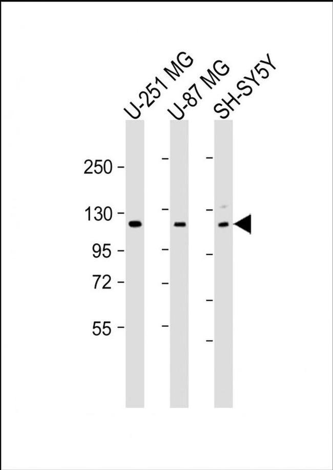 SH3PXD2B Antibody in Western Blot (WB)