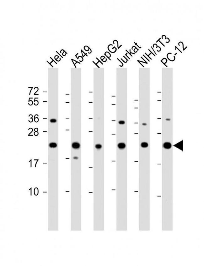 RPS7 Antibody in Western Blot (WB)