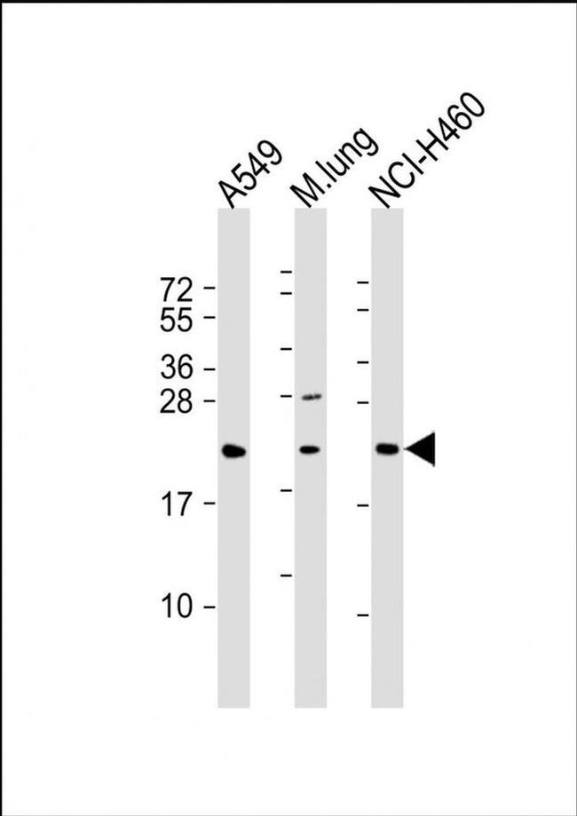 TUSC1 Antibody in Western Blot (WB)